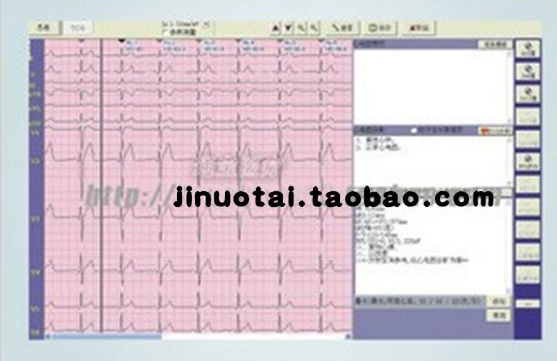 心电工作站/心电图机心电软件图片