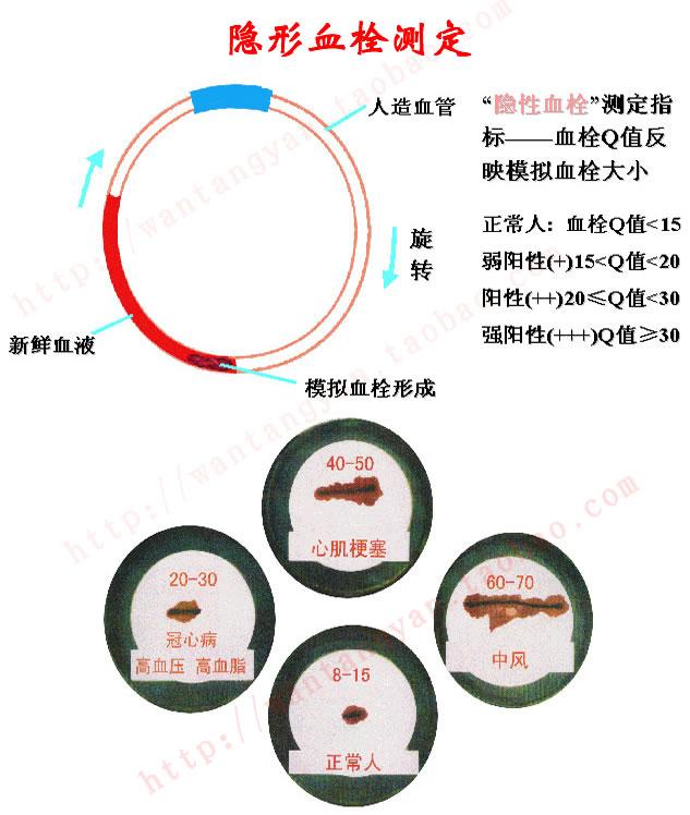 供應體外多環(huán)血栓檢測儀lmk-12型高血脂心肌梗塞心腦血管檢測儀