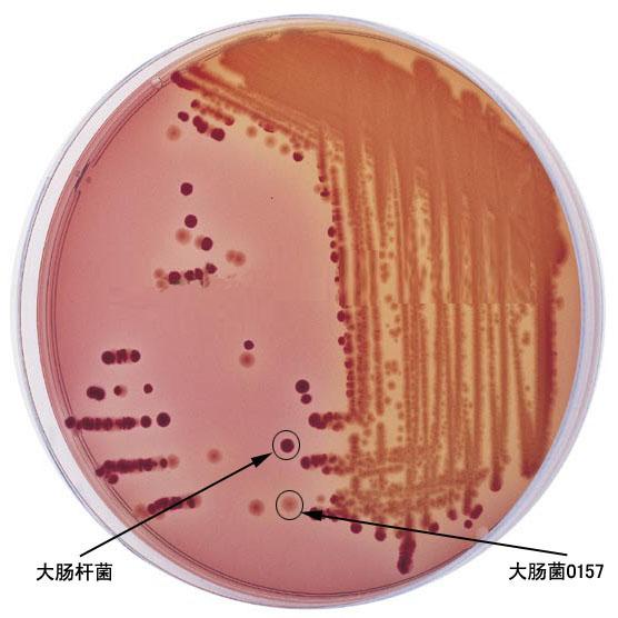 肠炎弧菌用TCBS琼脂培养基05204供应肠炎弧菌用TCBS琼脂培养基05204