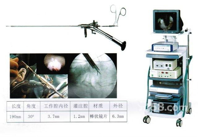 供應(yīng)椎間孔鏡的*方法