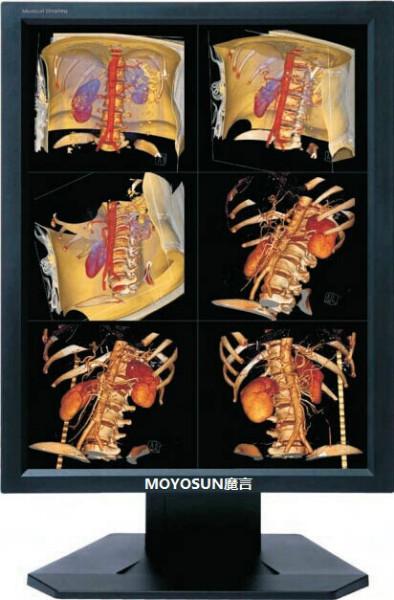 供应北京魔言3M彩色显示器，CT显示器，CR显示器，DR显示器，B超显示器图片