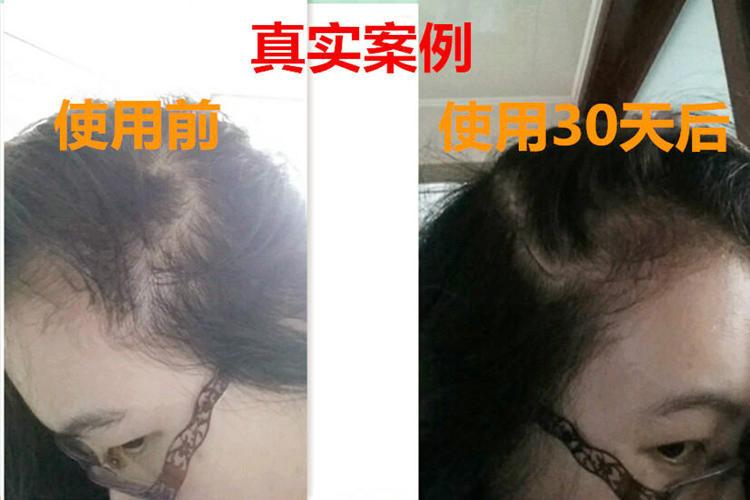 供应用于的女人肾虚吃什么好调养脱发脱脉塔瑶元堂